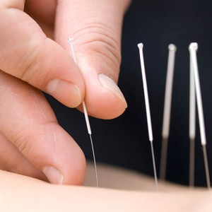 Akupunturbehandlung Dr. Gero Lenk Facharzt für Orthopädie Notfallmedizin und Sportmedizin Sonthofen im Oberallgäu